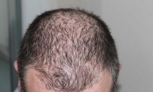 hair-248050_1040